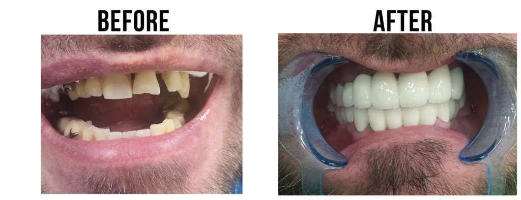 before-after-2