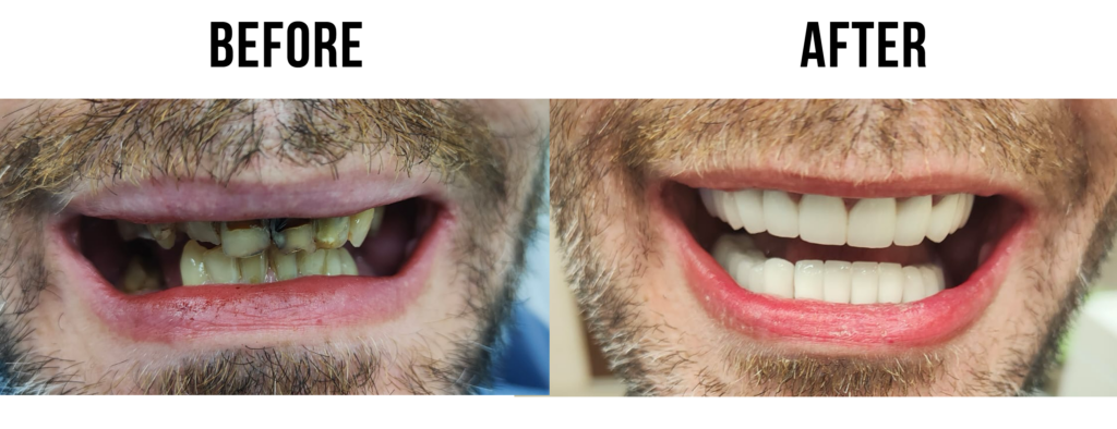 before-after-3