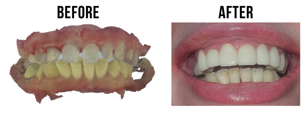 before-after-4