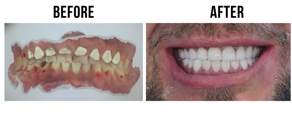 before-after-23