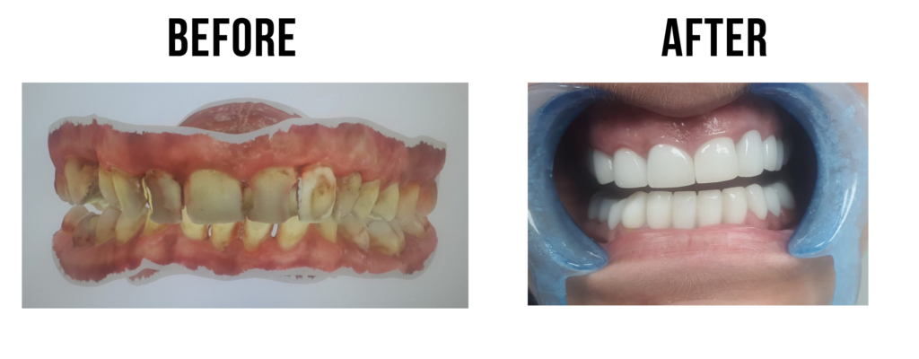 before-after-24