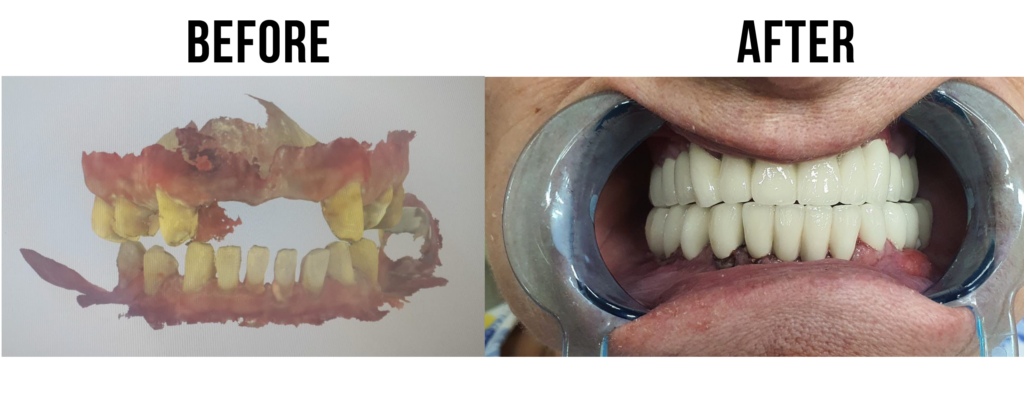 before-after-26