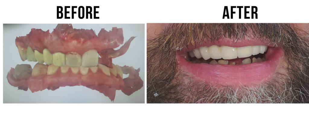 before-after-27
