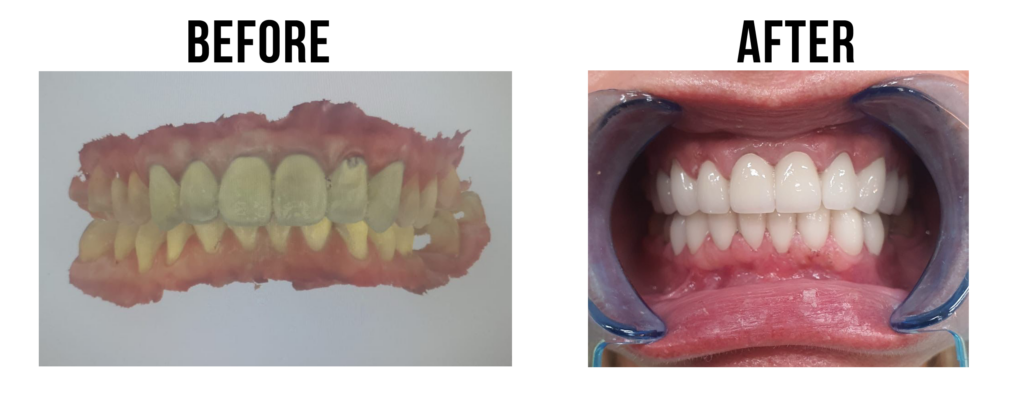 before-after-32