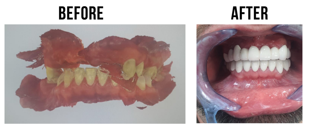 before-after-34