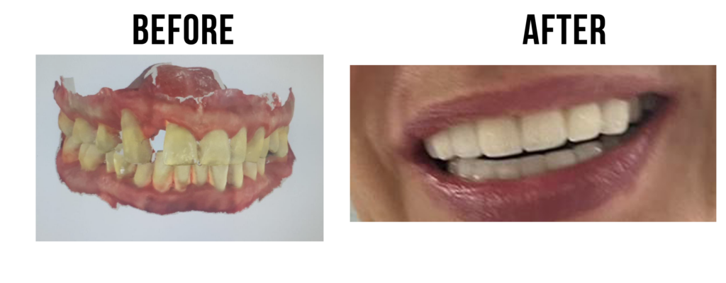before-after-36