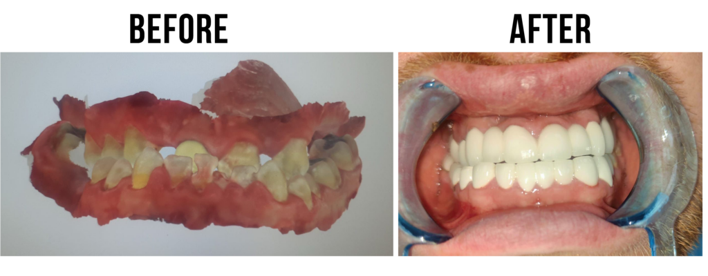 before-after-37