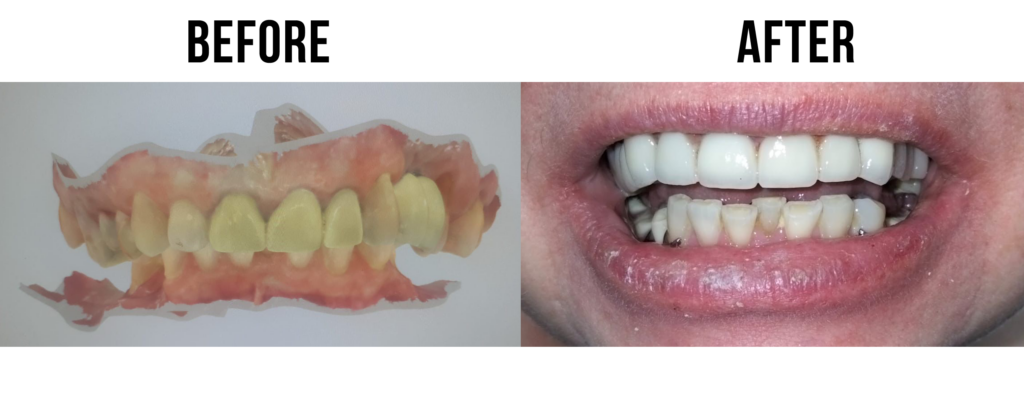 before-after-38