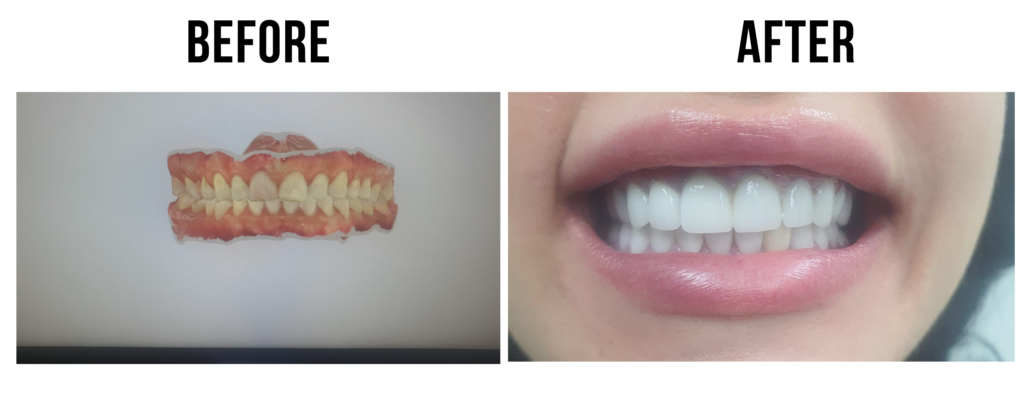 before-after-v2